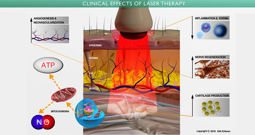 laser hair therapy