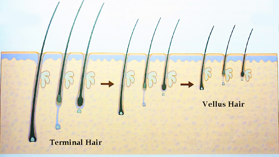 DHT mechanism