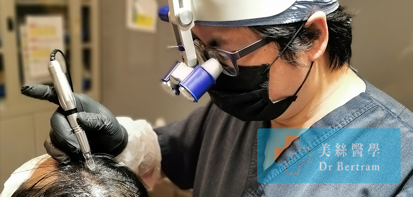 Scalp micropigmentation procedure