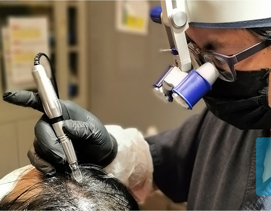 SMP procedure