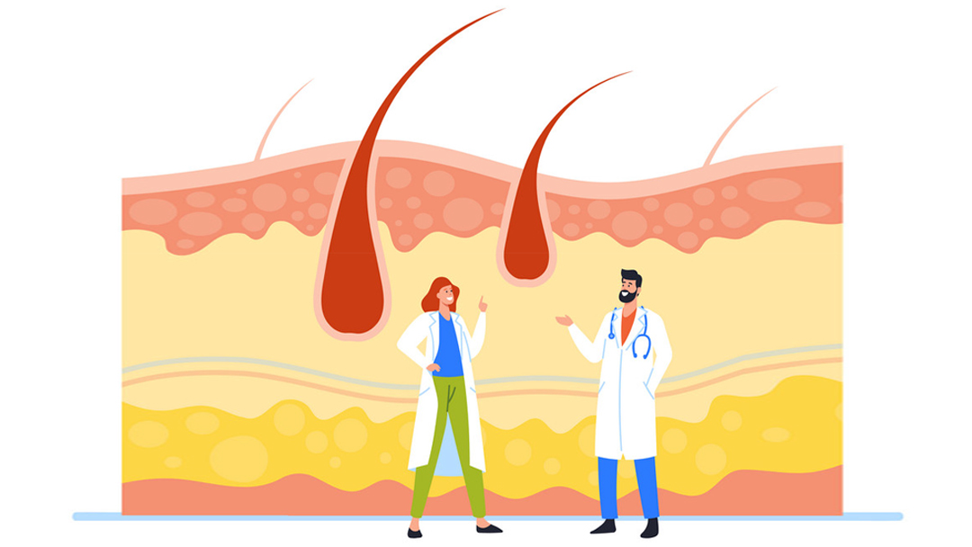 Trichoscopic comparison of different hair loss types