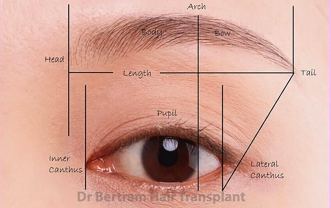 Eyebrow transplant technique and design