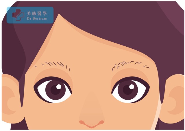 Thinning eyebrow