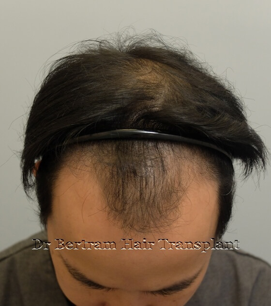 Before: Close-up view