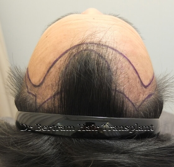 Before: Close-up view