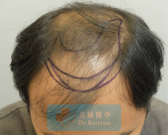 Before: Fine hair characteristics close-up