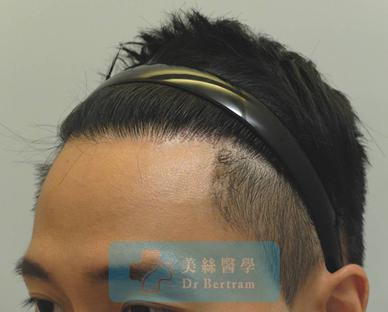 After: Natural transition