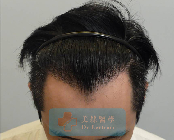 After: Natural transition