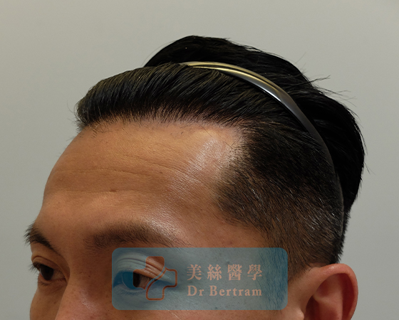 After: Natural transition