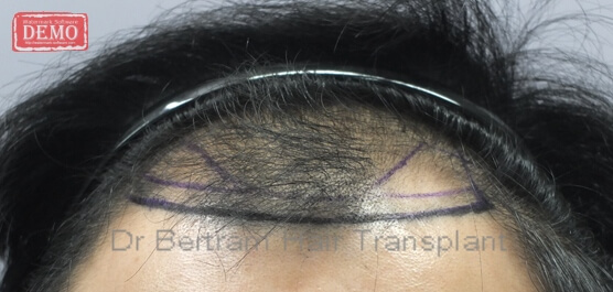 Before: Top view