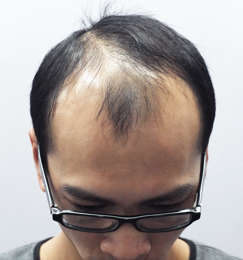 Before: Right side view