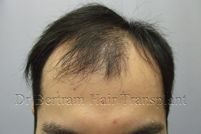 Clinical case: Male age 30
