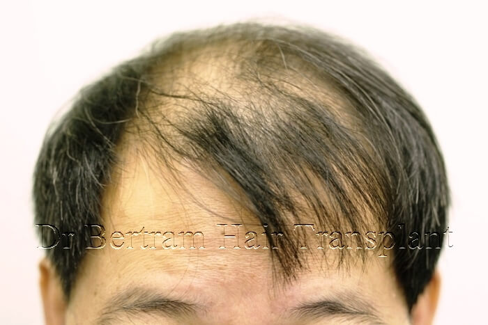 Clinical case: Male age 50