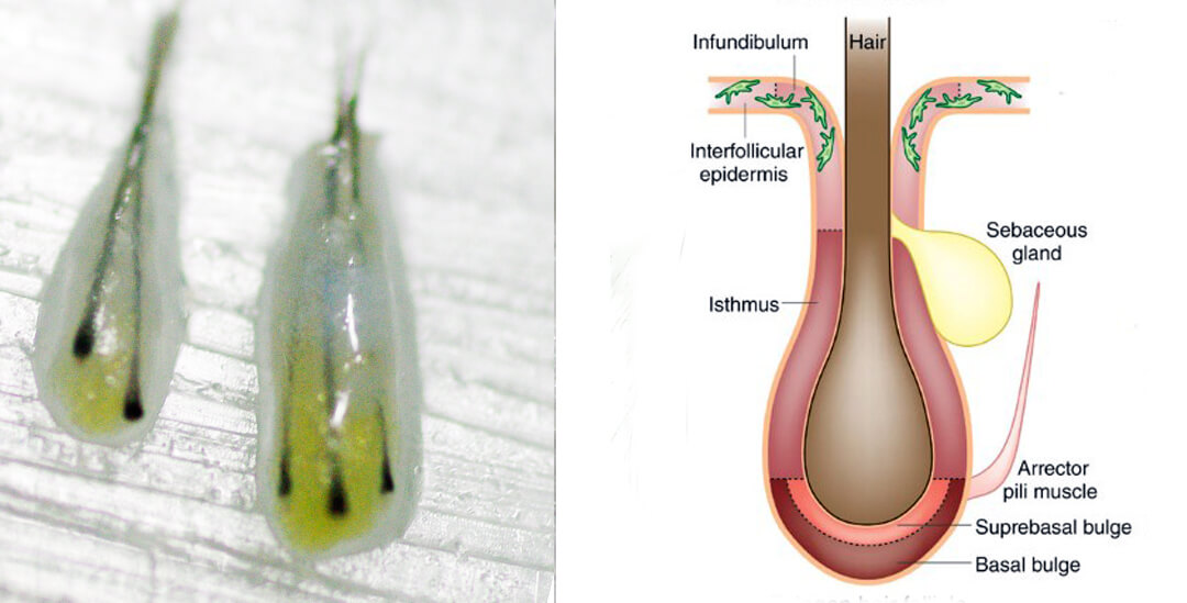 Follicular unit structure