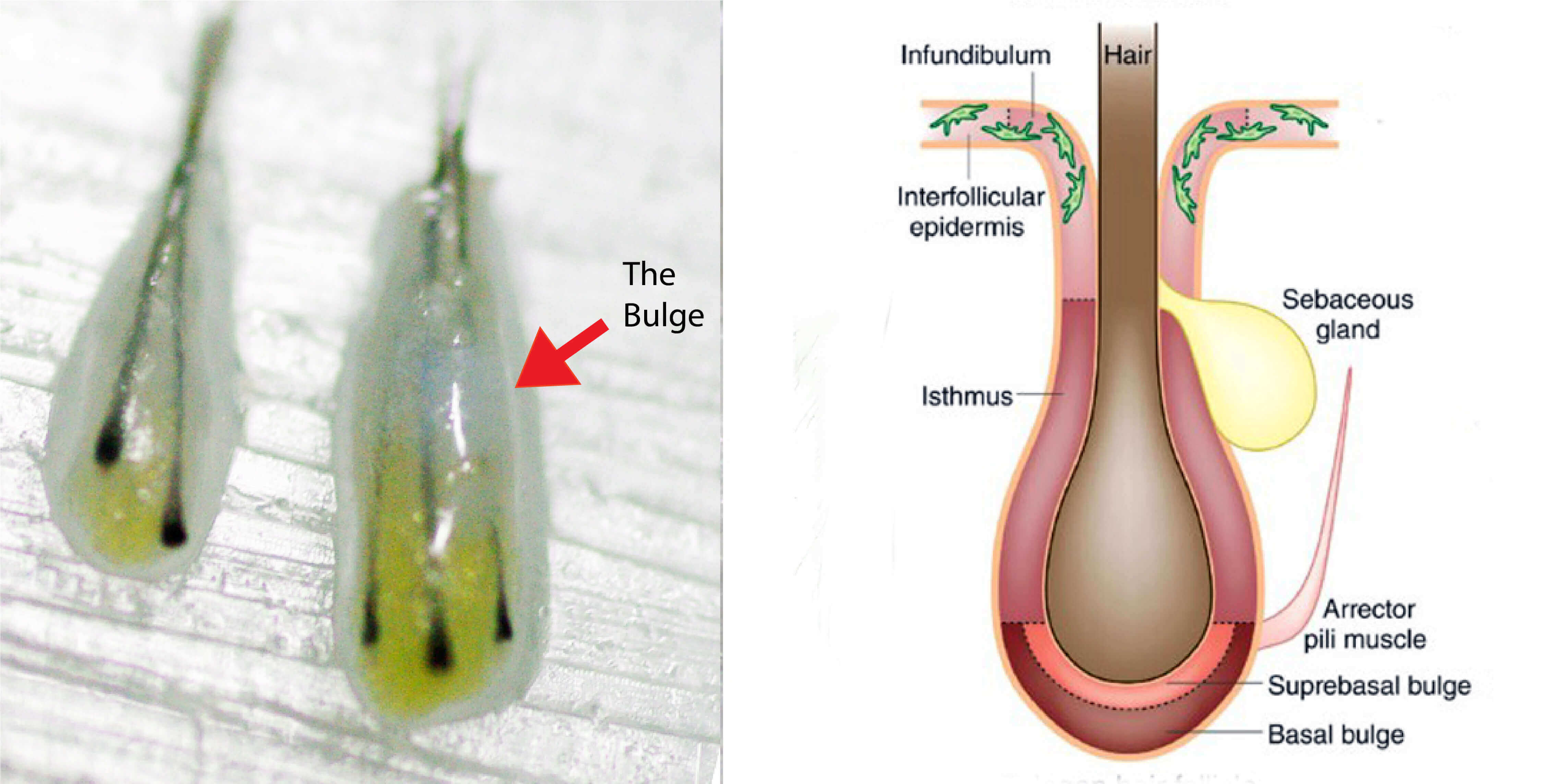Hair follicle diagram