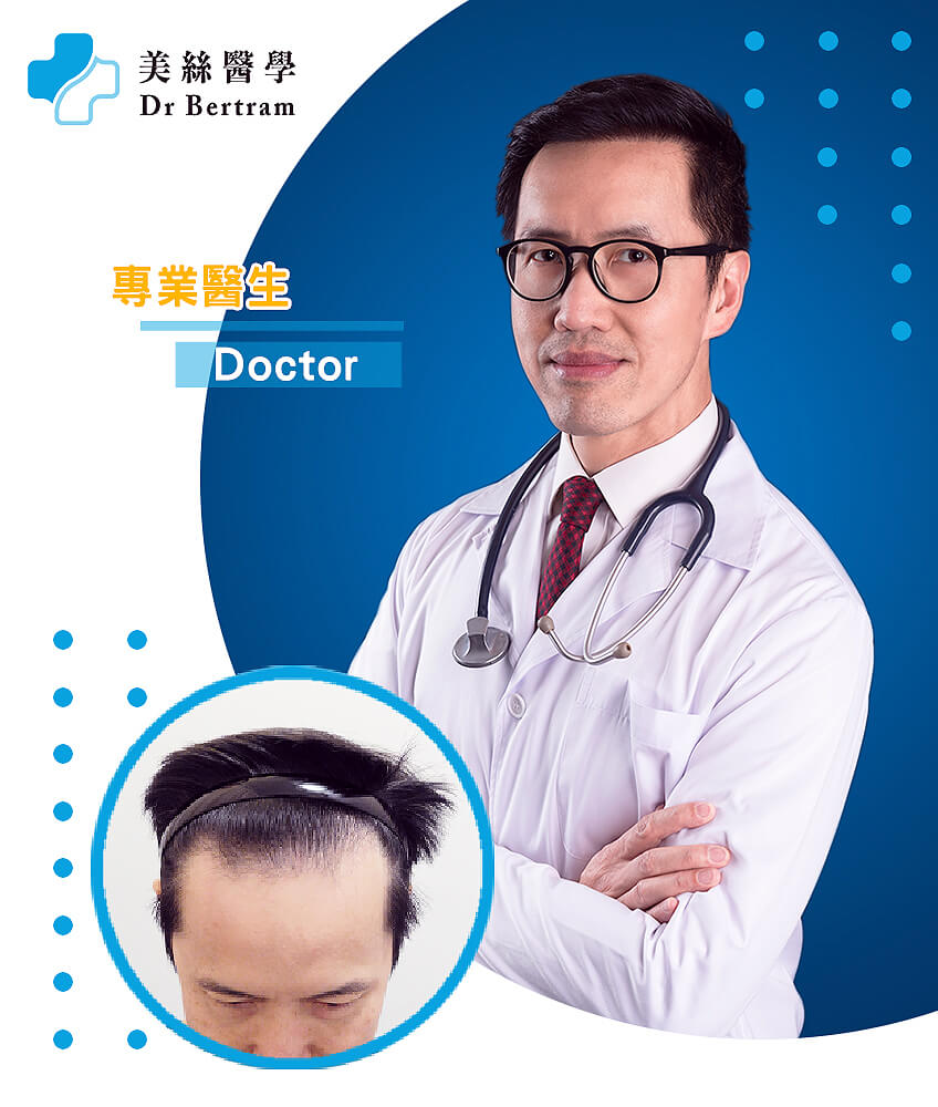 Hair restoration clinical result