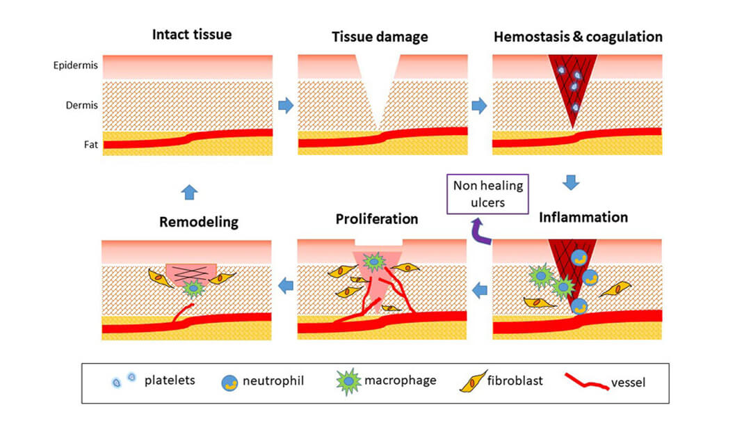 Revascularization timeline