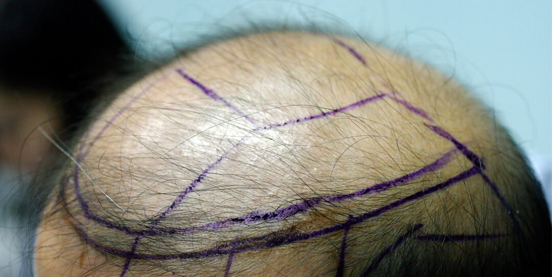 Surgical considerations